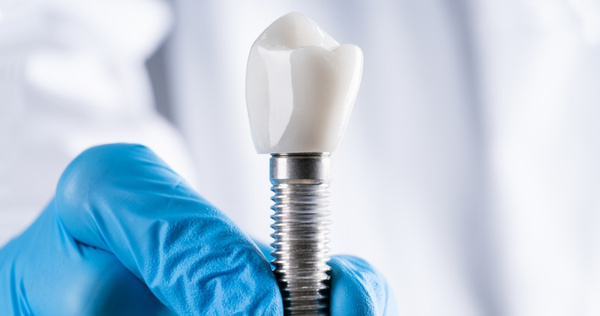 Close-up of a dental implant screw with crown held by a gloved hand during undergraduate surgical implant placement training