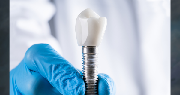 implant tooth being held by a blue gloved hand