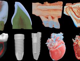 Micro-CT