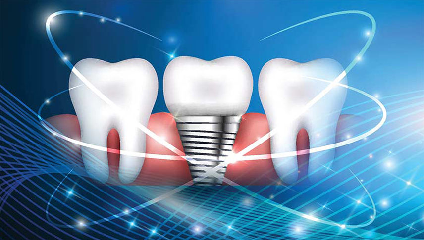 2022 LLU Implant Dentistry Continuum