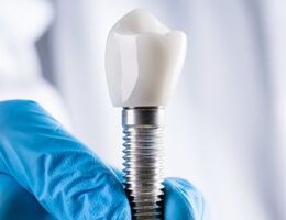 Close-up of a dental implant screw with crown held by a gloved hand during undergraduate surgical implant placement training