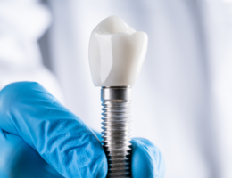 implant tooth being held by a blue gloved hand